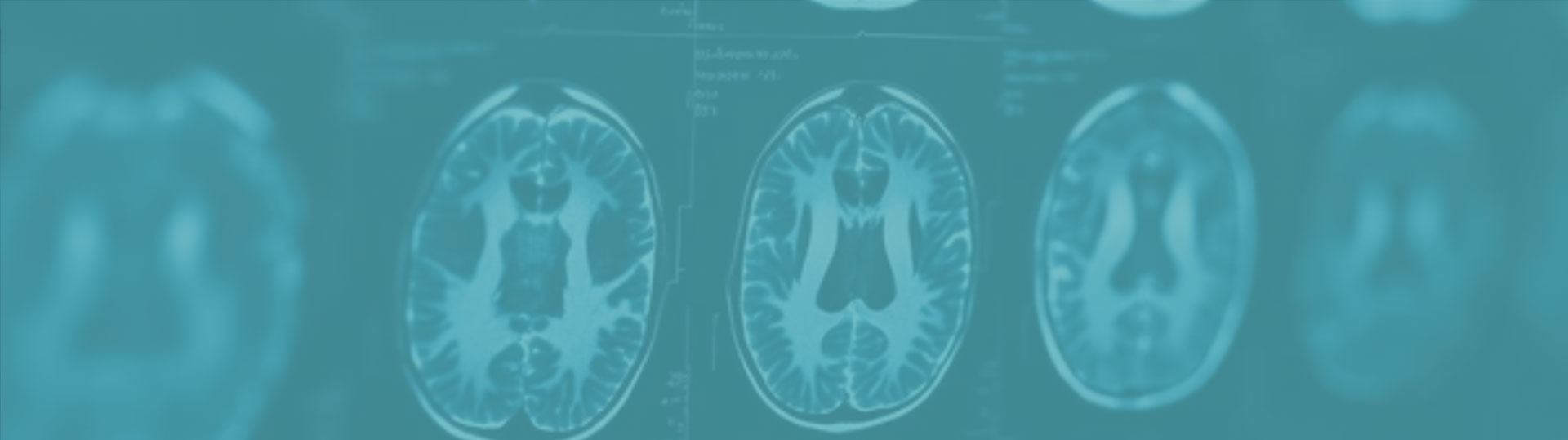 solutions_recherche_preclinique