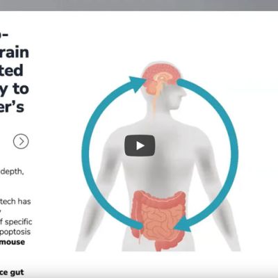 16-mai-24-Brain-Gut-Photobiomodulation