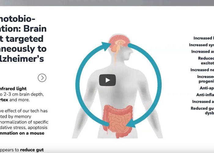 Brain-Gut Photobiomodulation: Preclinical and Clinical Studies for Alzheimer’s Disease.